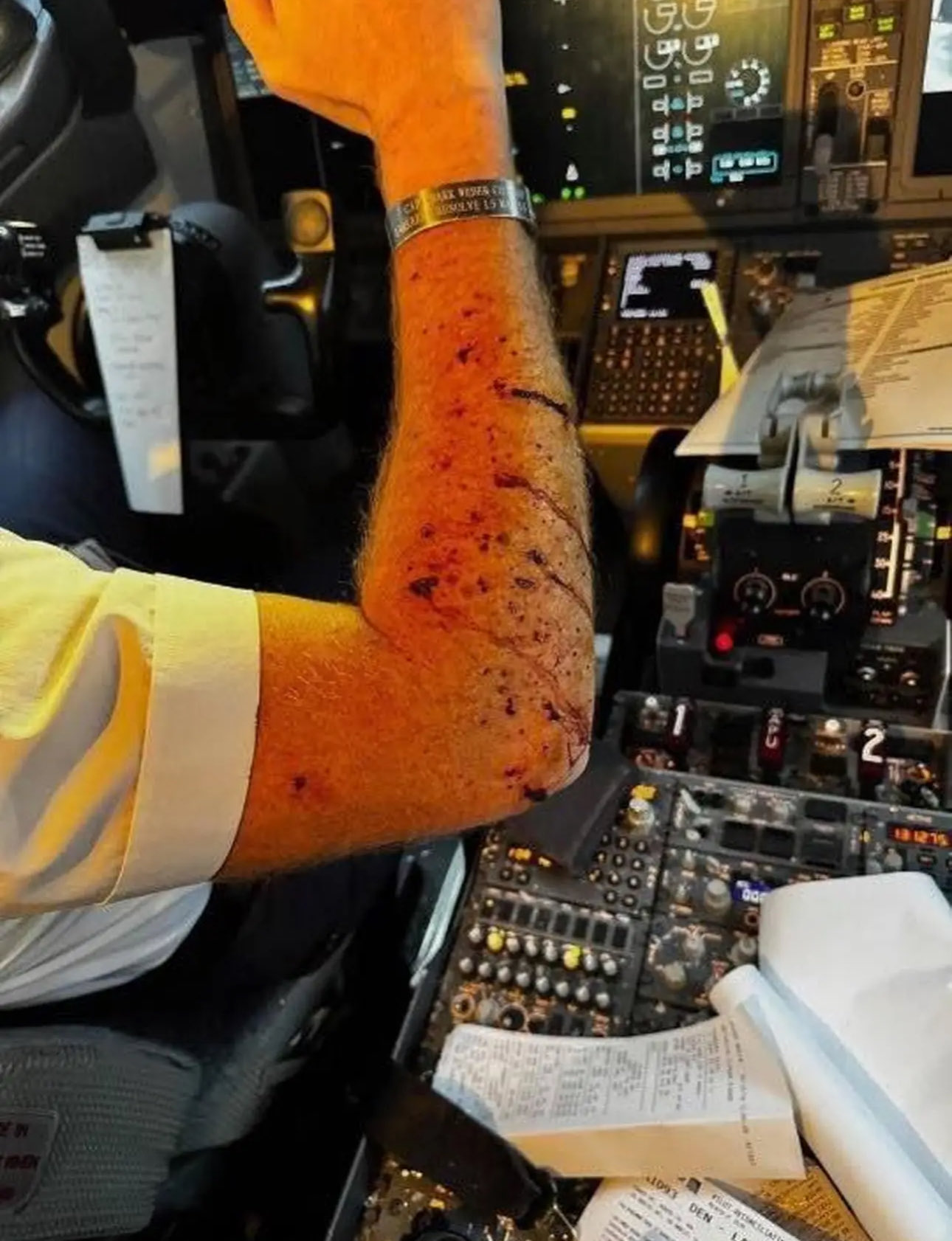 United Jet Diverted After Captain Feared Space Debris Cracked His Cockpit Windshield — It Was a Ba image